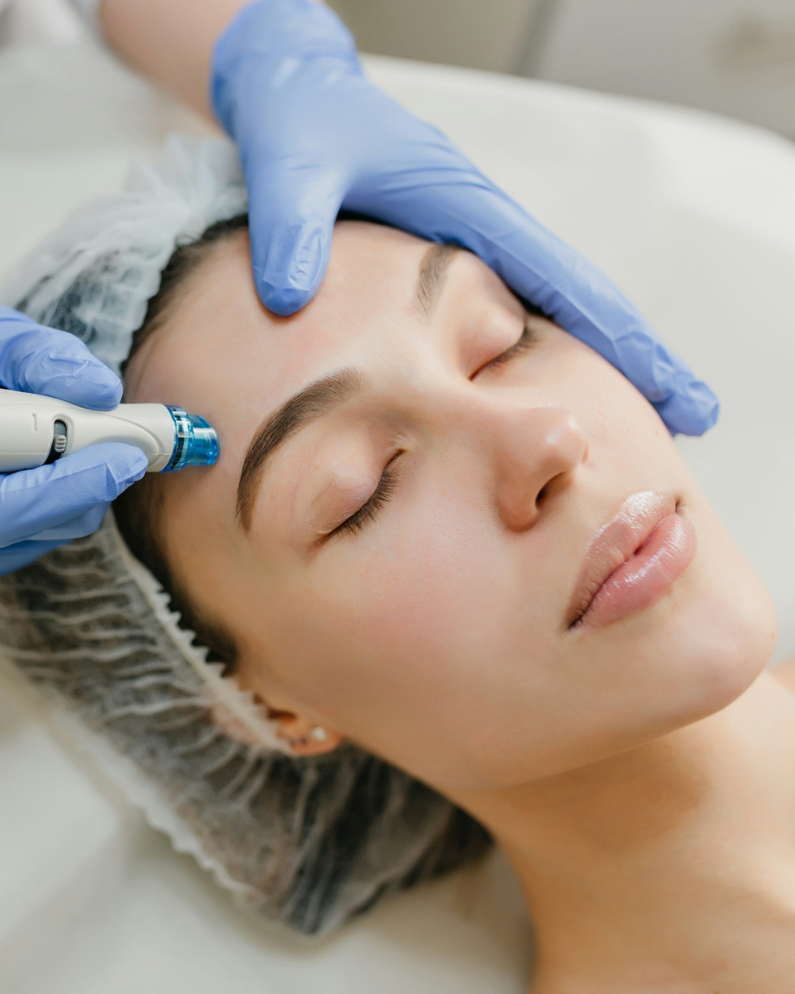 Procedimento dermatológico realizado com precisão e cuidado na Clínica Dra. Gisele Barbosa